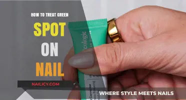 Effective Treatments for Green Spot on Nail: Causes and Solutions