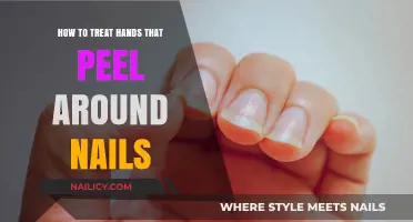 Effective Remedies for Peeling Skin Around Nails: A Comprehensive Guide
