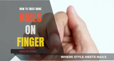 Treating Hang Nails: Quick and Easy Home Remedies