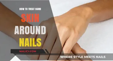Effective Tips to Soften and Treat Hard Skin Around Nails