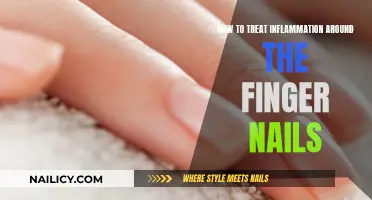 Treating Inflammation Around Finger Nails: Effective Home Remedies