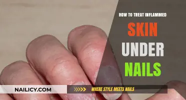 Soothing Inflamed Skin Under Nails: Effective Treatments and Remedies