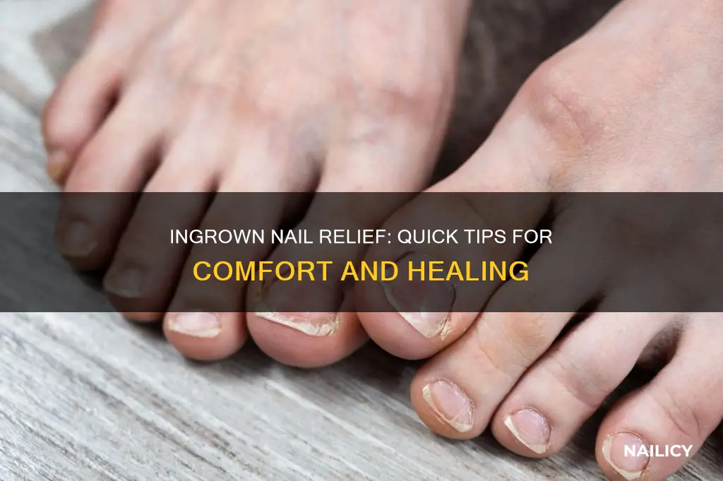 how to treat ingrown nail on finger