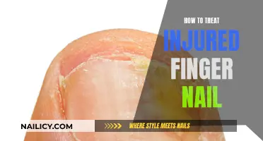 Nail Care 101: Healing Your Injured Fingernail