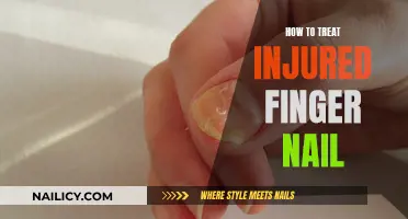 Treating Injured Fingernails: Quick Home Remedies for Healing