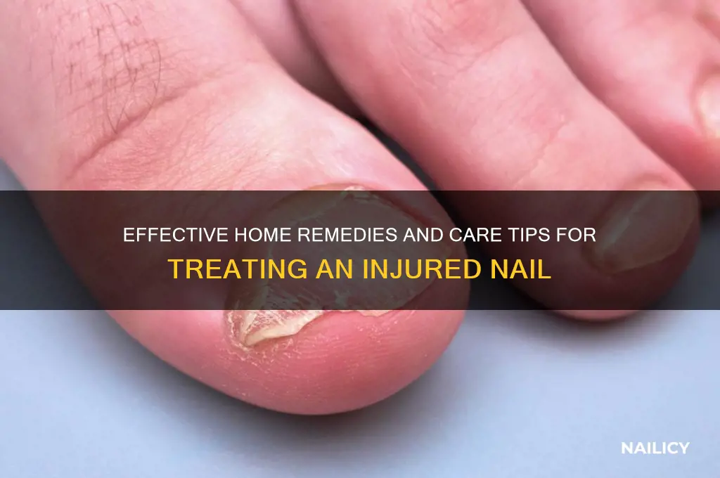 how to treat injured nail