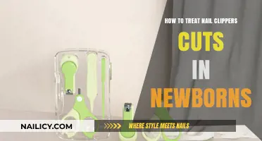 Treating Nail Clipper Cuts in Newborns