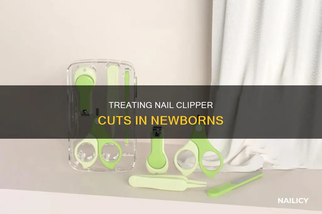 how to treat nail clippers cuts in newborns