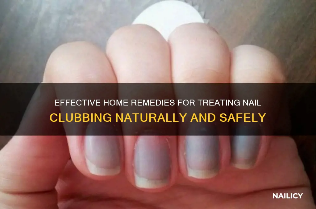 how to treat nail clubbing at home