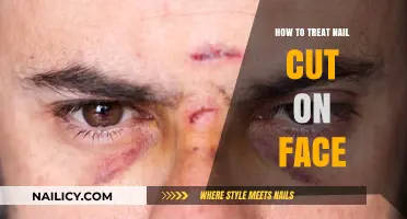 Treating Nail Cuts on Your Face: Quick Tips