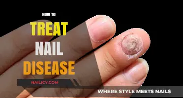 Effective Remedies for Nail Diseases: A Comprehensive Guide