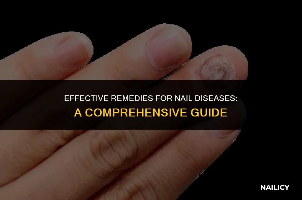how to treat nail disease