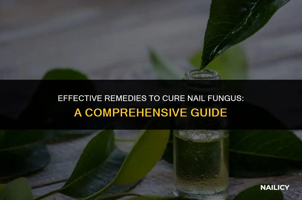 how to treat nail fingus