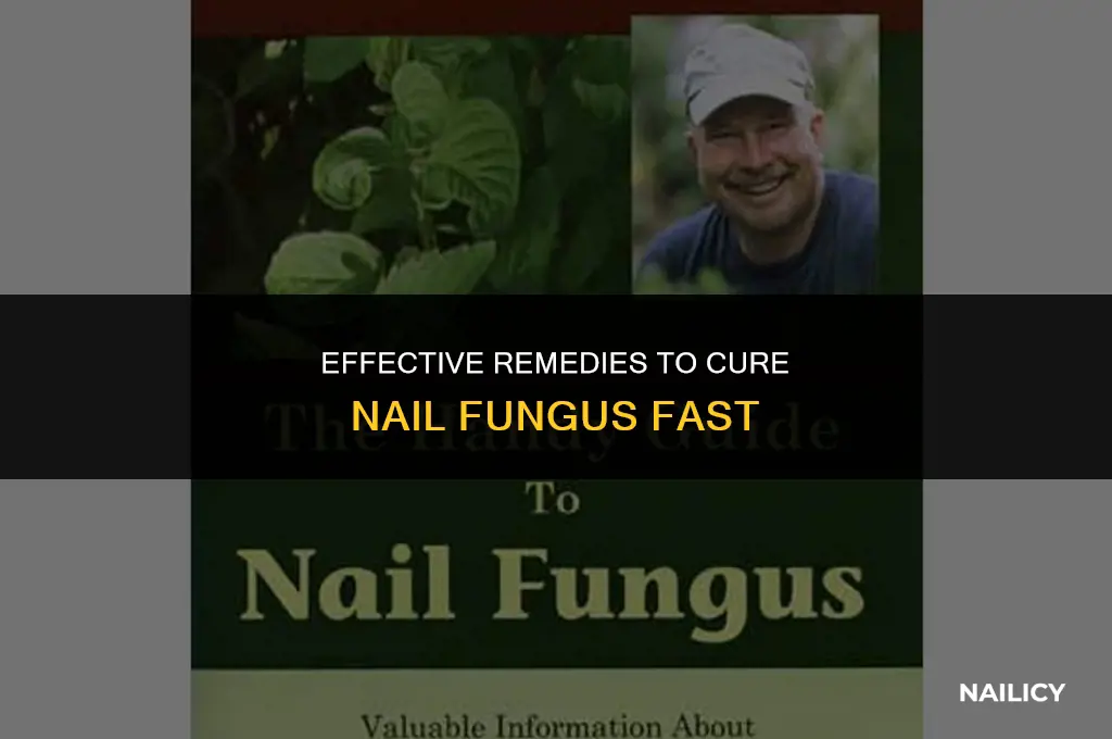 how to treat nail fungal