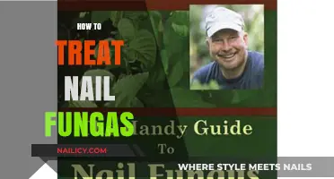 Effective Remedies to Combat Nail Fungus: A Comprehensive Guide