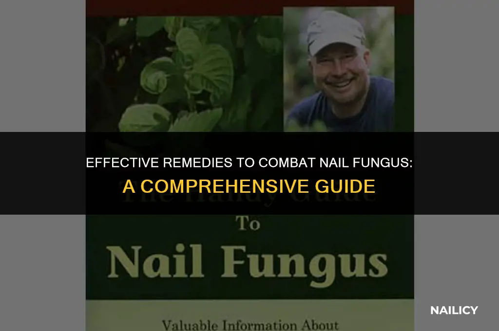 how to treat nail fungas