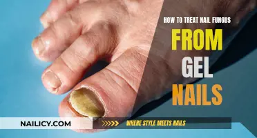 Gel Nails and Nail Fungus: Treatment and Prevention