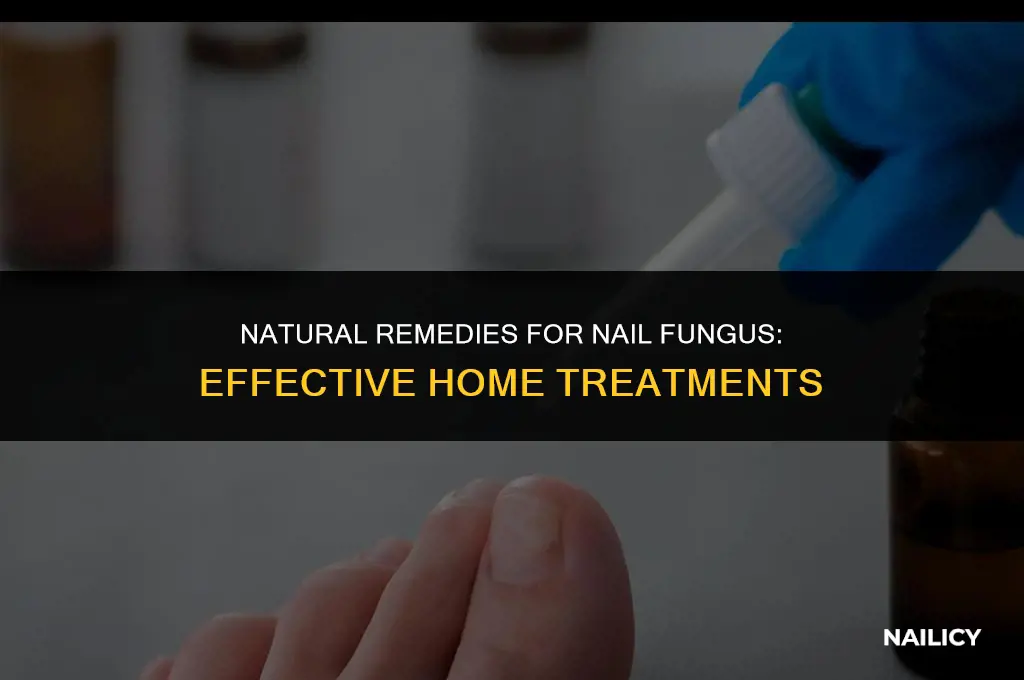 how to treat nail fungus using home remedies