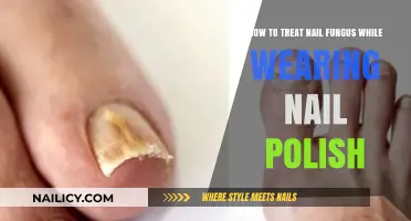 Conceal and Heal: Treating Nail Fungus Under Nail Polish