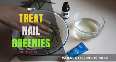 Natural Remedies for Treating Nail Greenies at Home