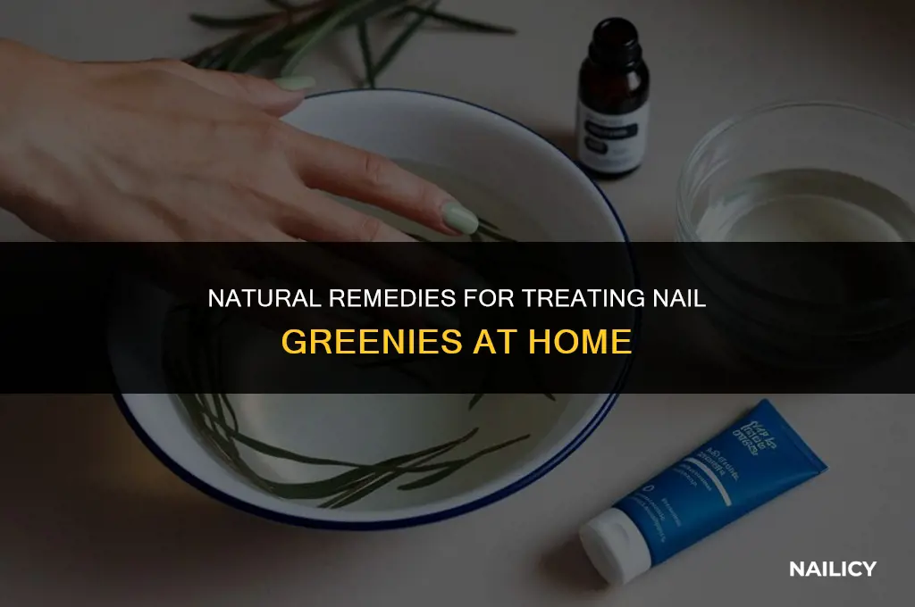 how to treat nail greenies