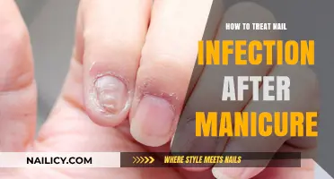 Treating Nail Infections Post-Manicure: Effective Remedies and Prevention Tips