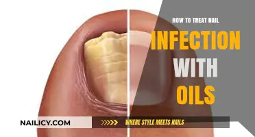 Natural Nail Infection Remedies: Healing with Essential Oils Guide