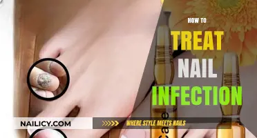 Effective Home Remedies and Treatments for Nail Infections: A Comprehensive Guide