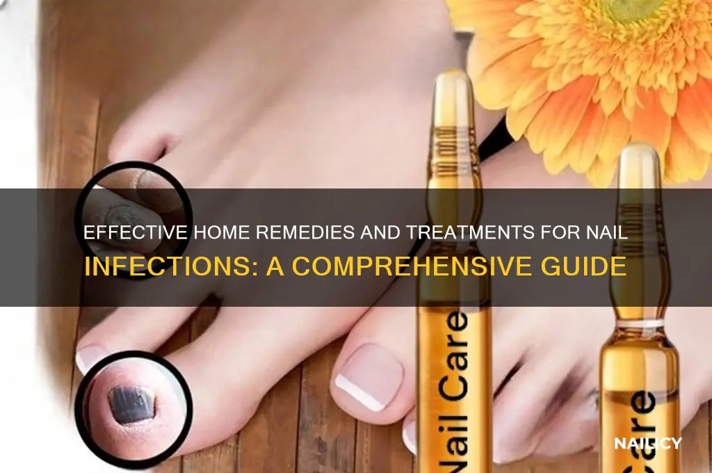 how to treat nail infection