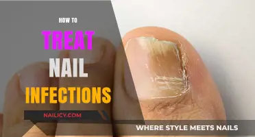 Effective Remedies for Nail Infections: A Comprehensive Guide