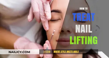 Effective Solutions for Treating and Preventing Nail Lifting at Home