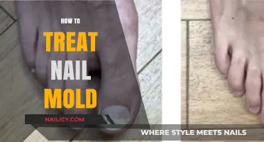 Effective Ways to Treat Nail Mold: A Comprehensive Guide
