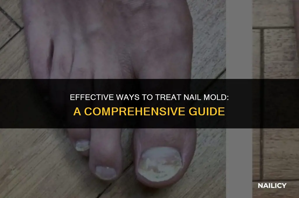 how to treat nail mold