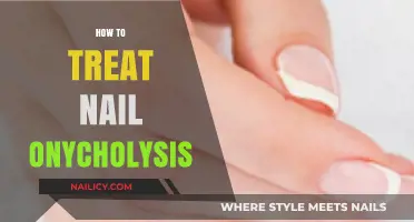 Effective Treatments for Nail Onycholysis: A Comprehensive Guide