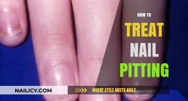 Nail Pitting: Effective Treatments and Prevention Tips