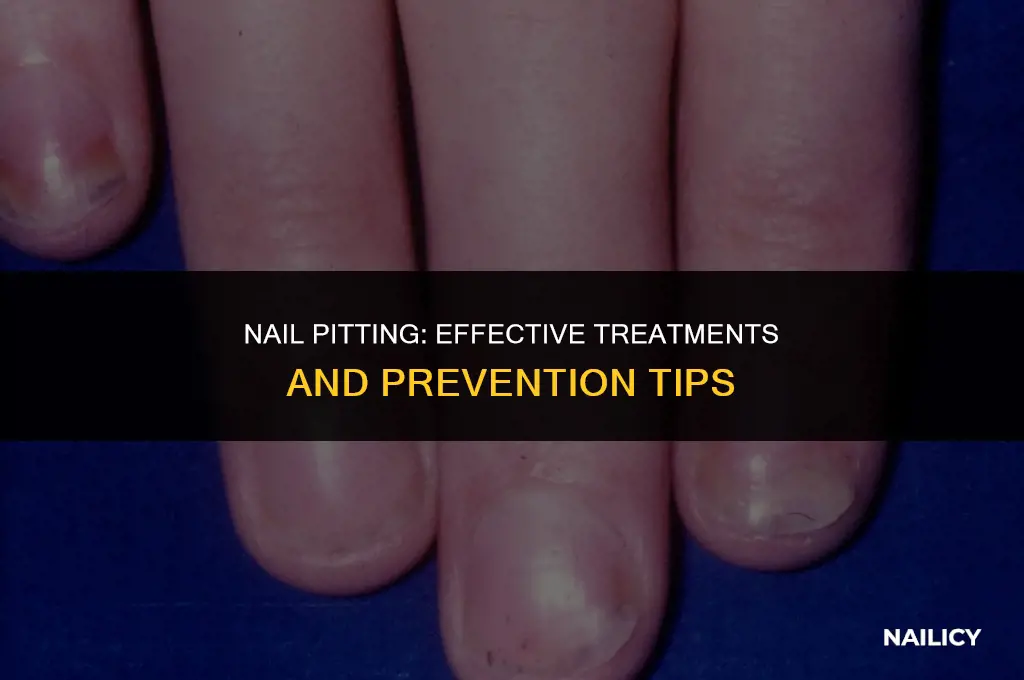 how to treat nail pitting