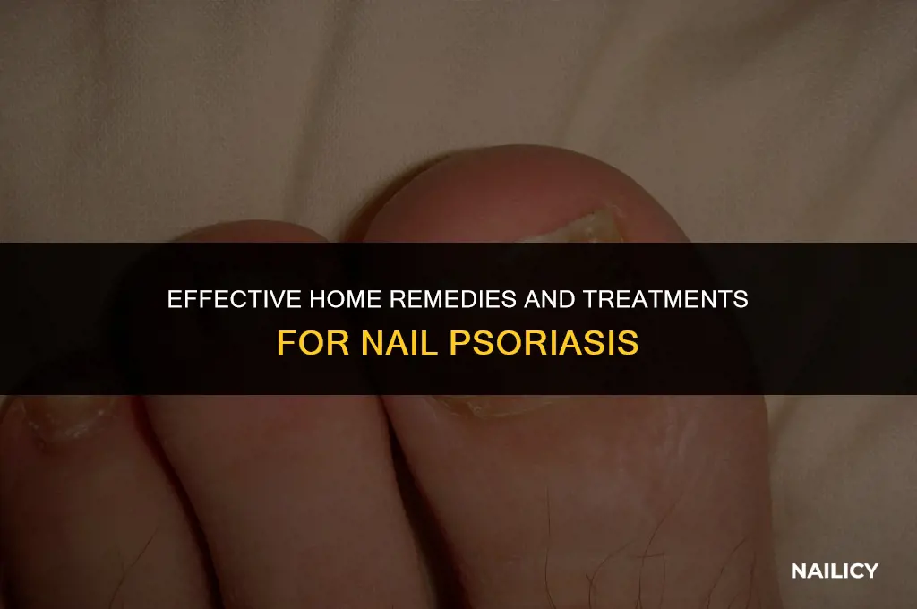 how to treat nail psiorirsi