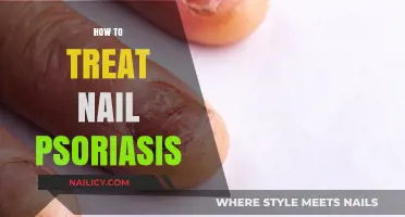 Effective Nail Psoriasis Treatment: Tips for Healthy, Clear Nails