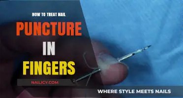 Effective Treatment Tips for Nail Puncture Injuries in Fingers