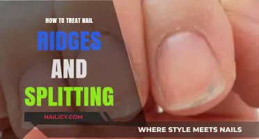 Effective Solutions for Treating Nail Ridges and Splitting Naturally