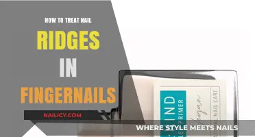 Effective Ways to Smooth and Treat Nail Ridges in Fingernails