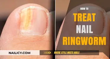 Effective Remedies for Nail Ringworm: A Comprehensive Guide