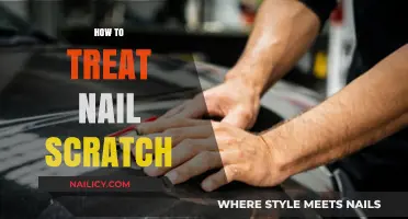 Effective Home Remedies to Treat Nail Scratches Quickly