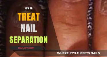 Effective Ways to Treat Nail Separation at Home