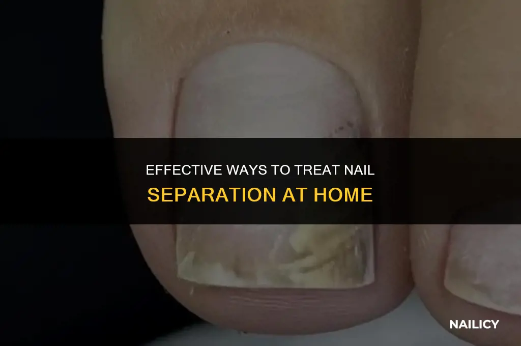 how to treat nail separation