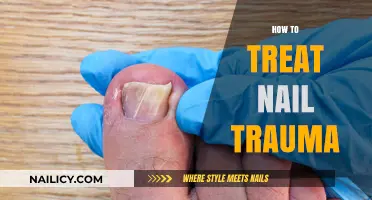 Healing Hurt Nails: A Comprehensive Guide to Treating Nail Trauma