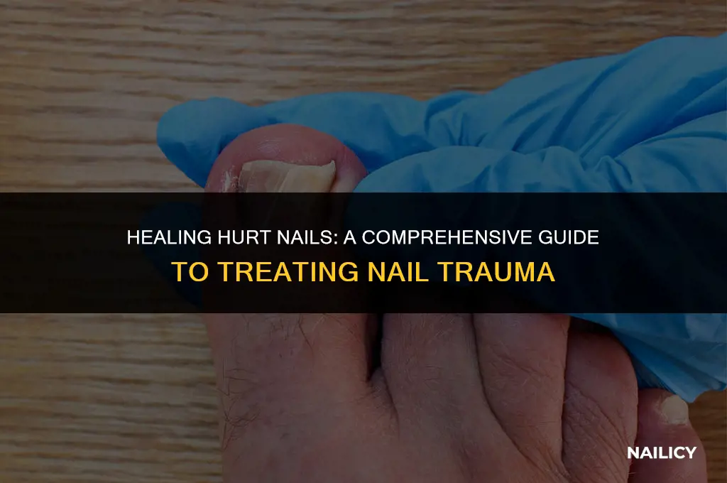 how to treat nail trauma