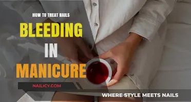 Effective Remedies for Bleeding Nails During Manicures: A Gentle Guide