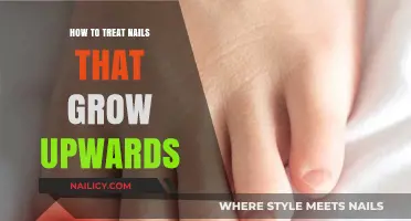 Treat Nails Growing Upwards: A Simple Guide