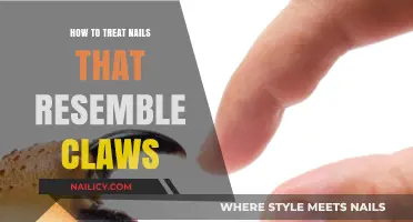 Transform Claw-Like Nails: Effective Treatments for Stronger, Healthier Hands